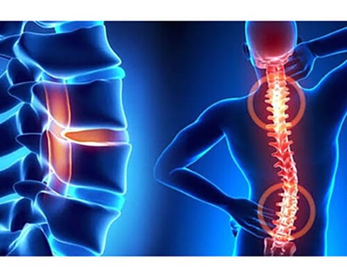 Yüzme Sporunun İskelet Yapısına Etkisi