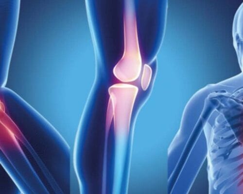 Yüzmenin Eklemlere Faydası